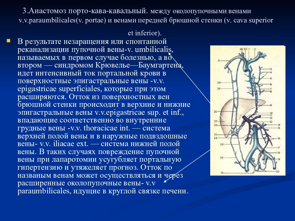 Портокавальные кава кавальные. Кава портальные анастомозы. Портокавальный анастомоз. Поверхностная надчревная Вена анастомоз. Воротная Вена анастомозы.