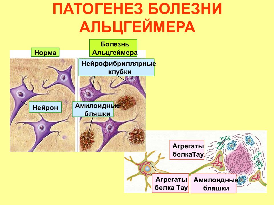 Белки альцгеймера