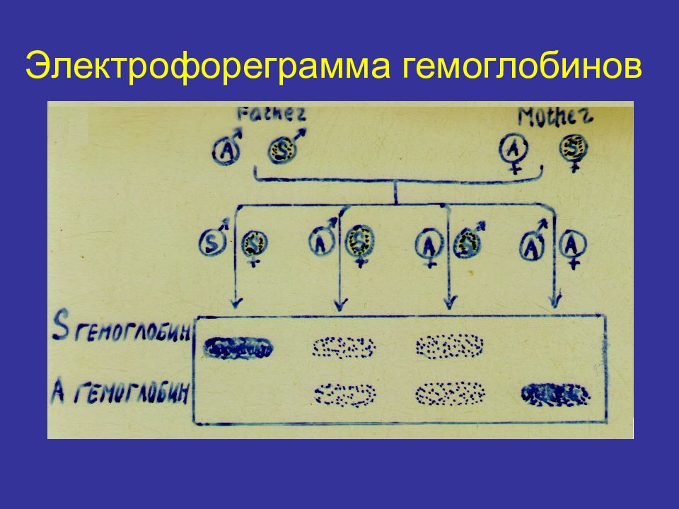 Генетическая 2. Электрофореграмма гемоглобина. Электрофореграмма фракции гемоглобина. Полиморфизм гемоглобина. Полиморфизм гемоглобина презентация.