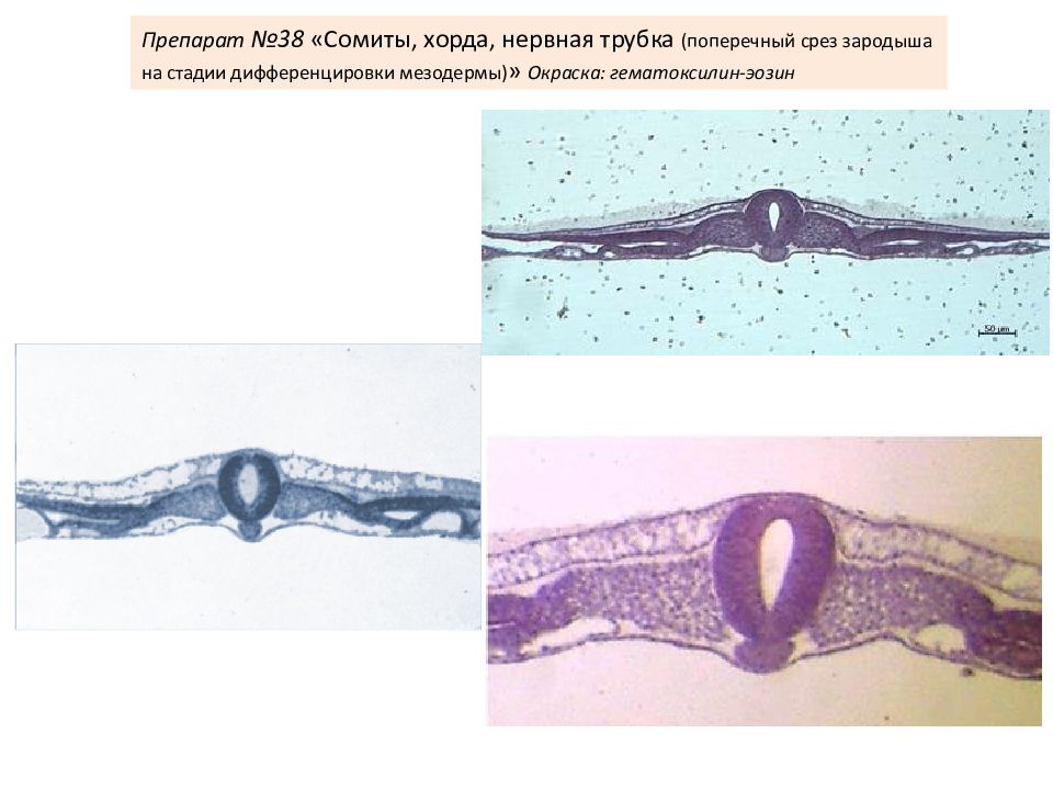 Стадии зародыша курицы. Препарат сомиты хорда нервная трубка гистология. Сомиты хорда и нервная трубка препарат. Сомиты хорда и нервная трубка зародыша курицы препарат. Поперечный срез зародыша гистология.