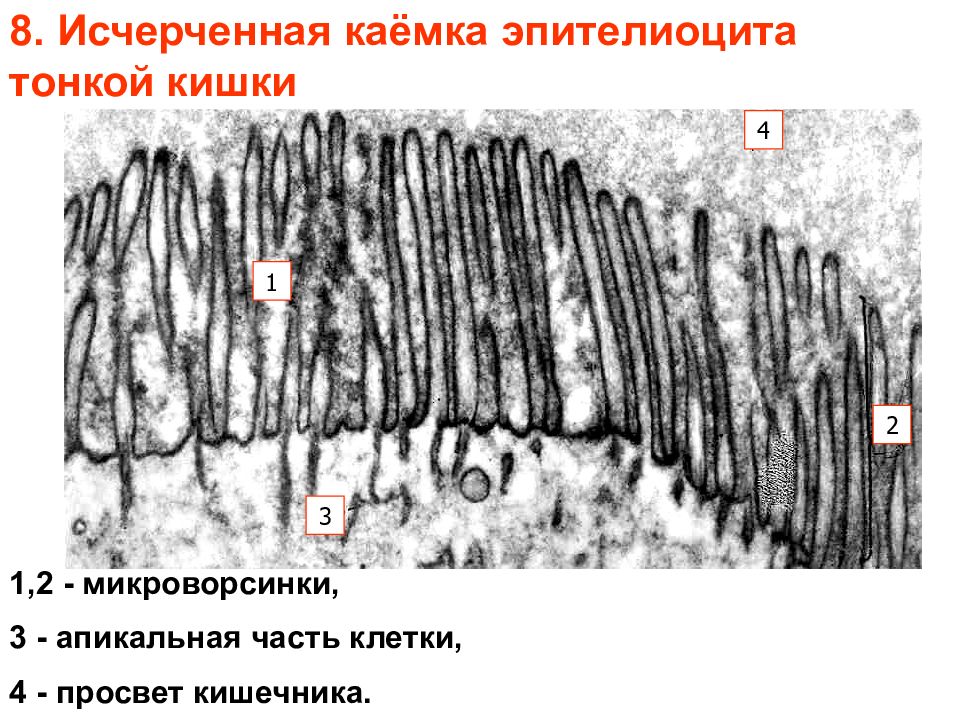 Исчерченный. Гликокаликс микроворсинки. Микроворсинки кишечника гистология. Микроворсинки эпителия кишечника. Гликокаликс микроворсинок.