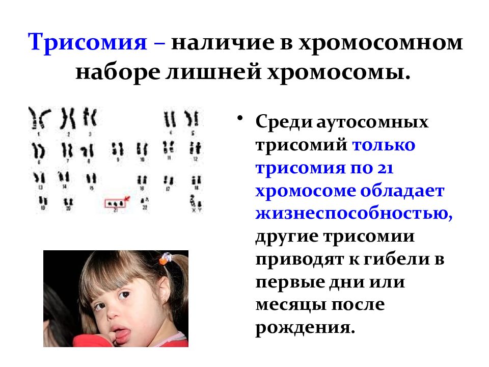 Аутосомные хромосомы заболевание. Синдром трисомии хромосомы 8. Синдром трисомии хромосомы. Трисомия в хромосомном наборе.