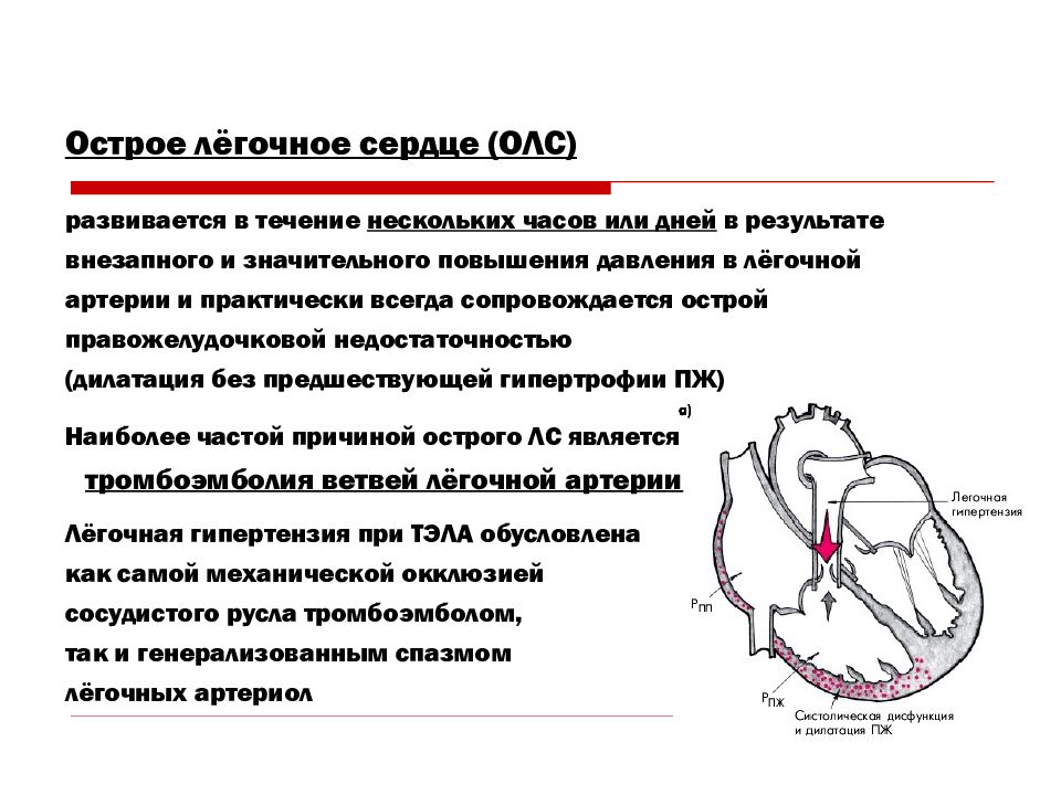 Легочное сердце презентация