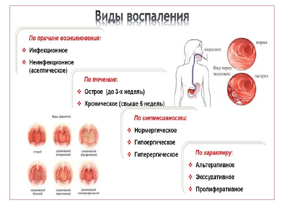 Воспаление где. Виды воспаления.