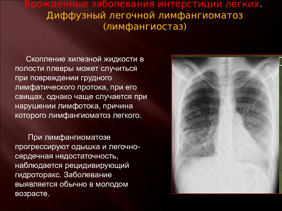 Патология легких. Врожденныезоболевания легких. Врожденные заболевания легких. Врождённые патологии лёгких. Врожденные аномалии легких.