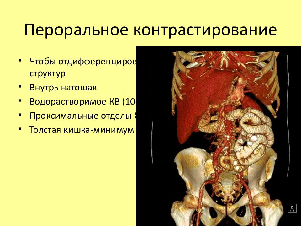 Мскт органов брюшной полости. МСКТ брюшной полости с контрастированием. Кт с пероральным контрастированием. МСКТ органов брюшной полости с контрастированием.