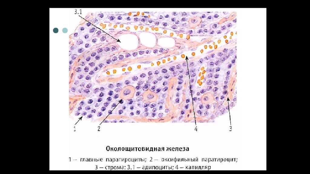 Гиперплазия паращитовидной железы. Паращитовидная железа гистология препарат. Околощитовидная железа гистология препарат. Околощитовидная железа строение гистология. Строение паращитовидной железы гистология.