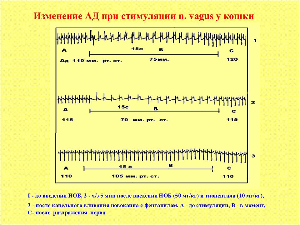 При стимуляции м2-хр. При стимуляции м1- и м3-хр. Порог регистрации м-ответа при стимуляции.