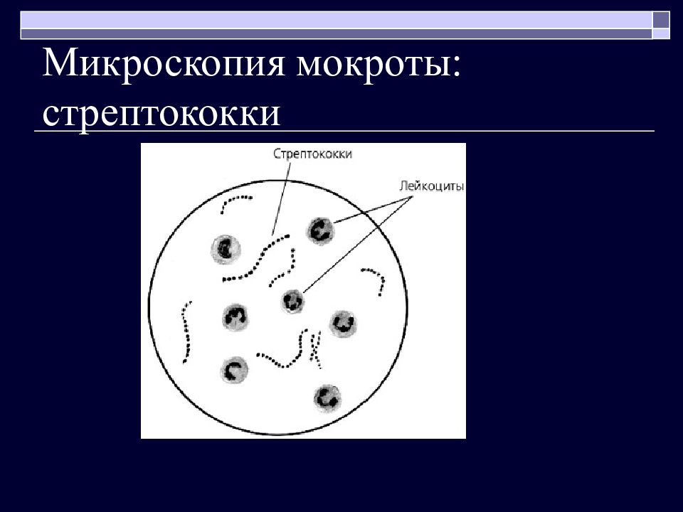 Микроскопия. Микроскопия мокроты пневмококки. Стрептококк микроскопия. Микроскопия мокроты атлас.