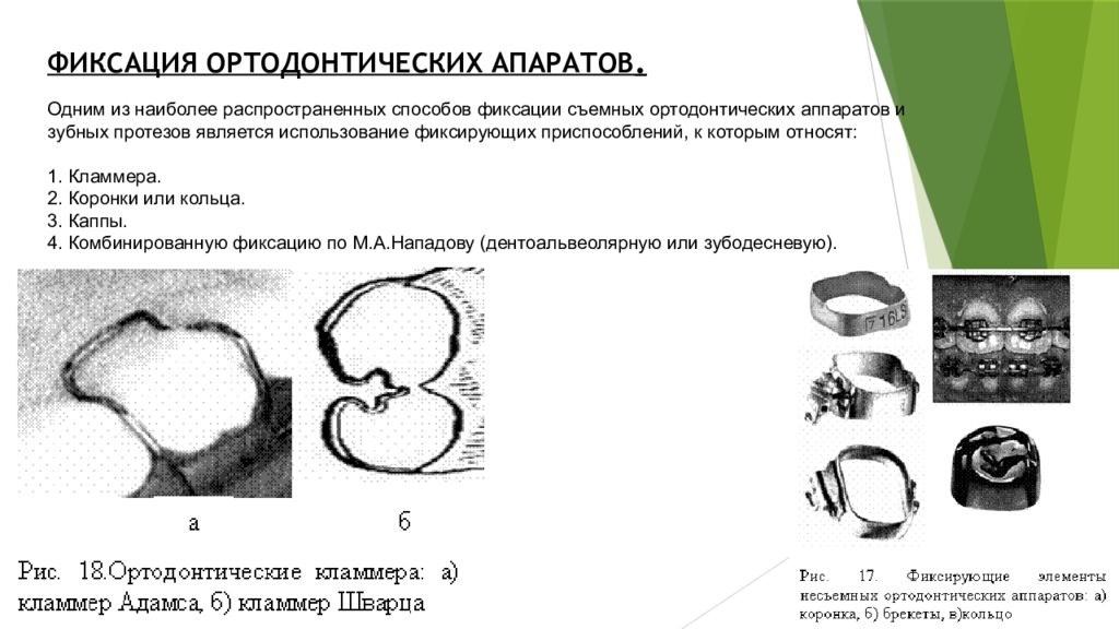 Кламмер адамса. Кламмер -элемент для фиксации ортодонтических аппаратов. Элементы съемных ортодонтических аппаратов. Кламмер ортодонтия классификация. Классификация съемных ортодонтических аппаратов.