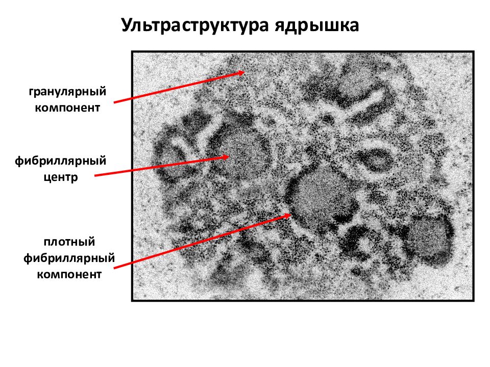 Ядрышко. Ультраструктура ядрышка. Фибриллярный и гранулярный компонент ядрышка. Гранулярное компонент ядрышка строение. Фибриллярный компонент ядрышка.