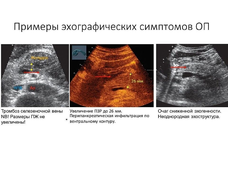 Узи сосудов почек подготовка к исследованию