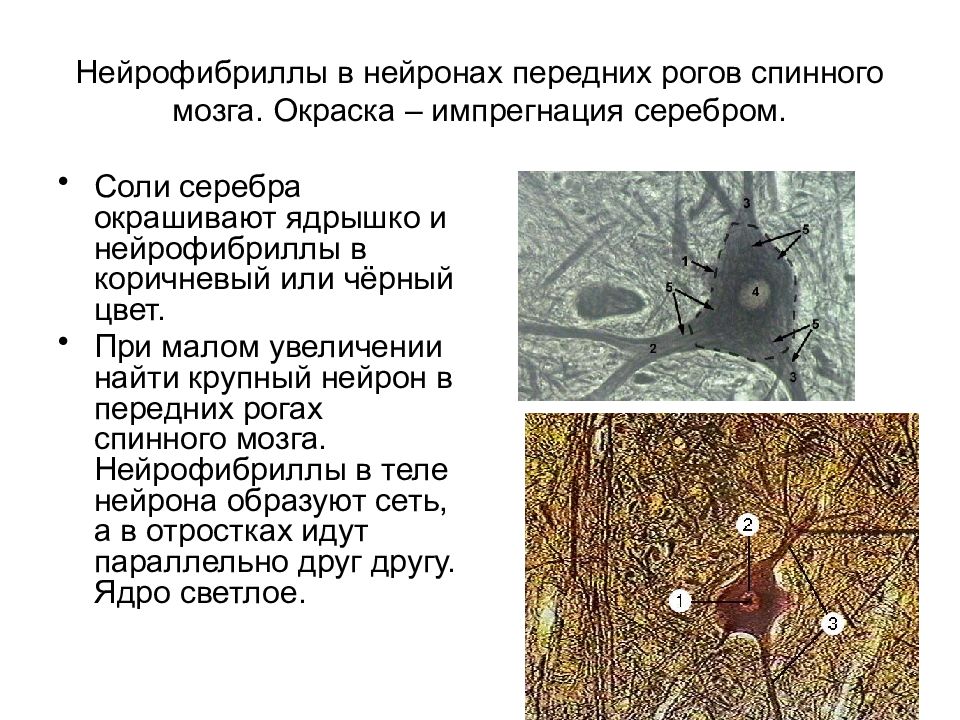 Клетки спинного мозга. Спинной мозг окраска импрегнация серебром. Нейрофибриллы в спинном мозге препарат. Нейрофибриллы в нервных клетках препарат. Нейрофибриллы импрегнация солями серебра.