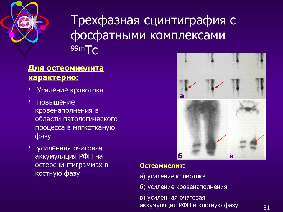 Что такое сцинтиграфия