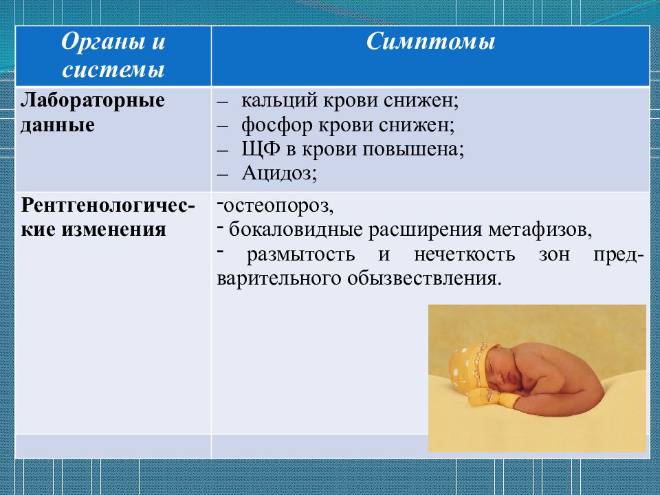 Презентация на тему профилактика рахита у детей