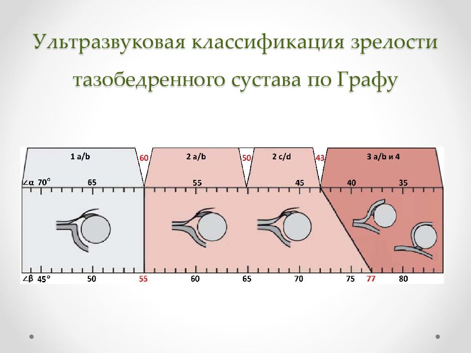 Ультразвуковая классификация зрелости тазобедренного сустава по Графу