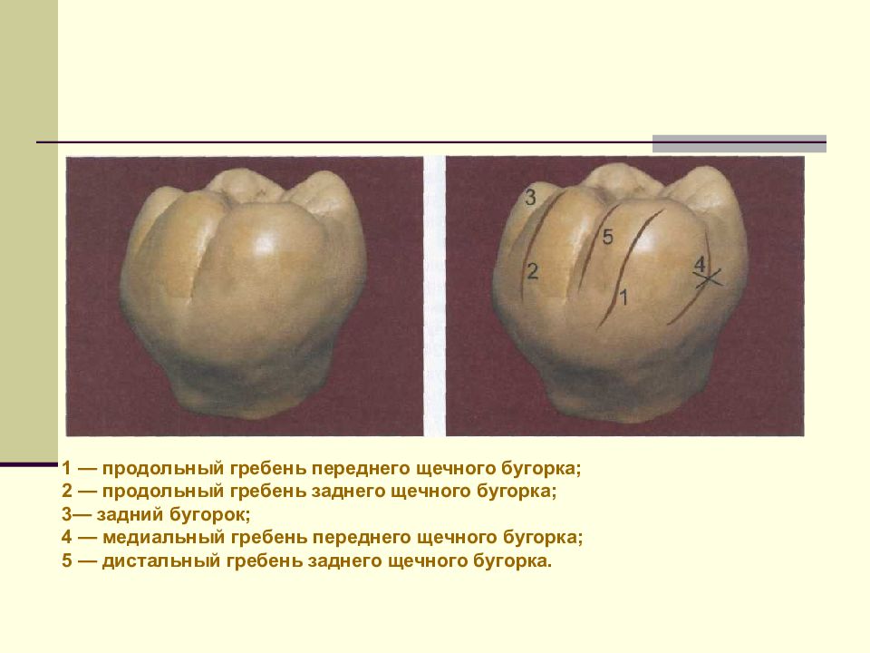 Первый моляр верхней челюсти бугры. Нижний первый моляр бугорки. Бугры первого Нижнего моляра. Бугры моляров нижней челюсти. Первый моляр нижней челюсти Бугры.