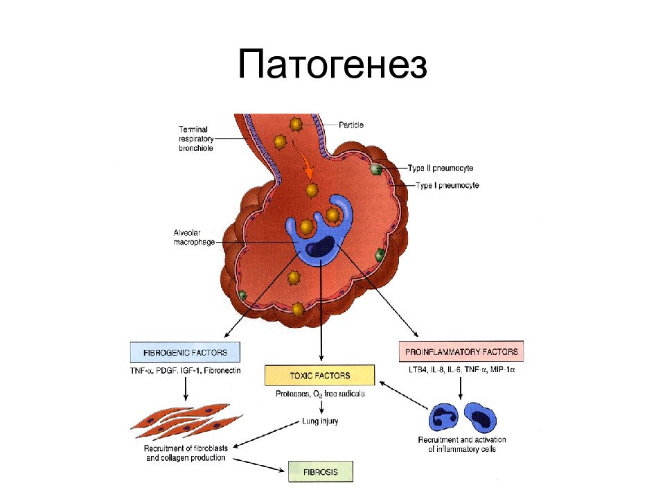 Патогенез картинка для презентации