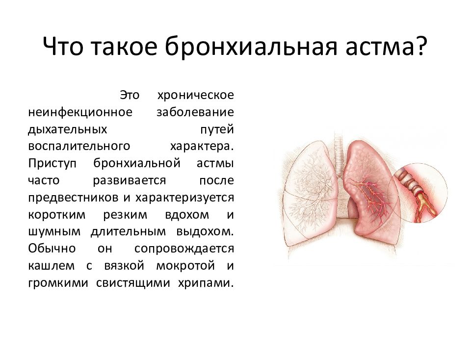 Лфк при бронхиальной астме презентация