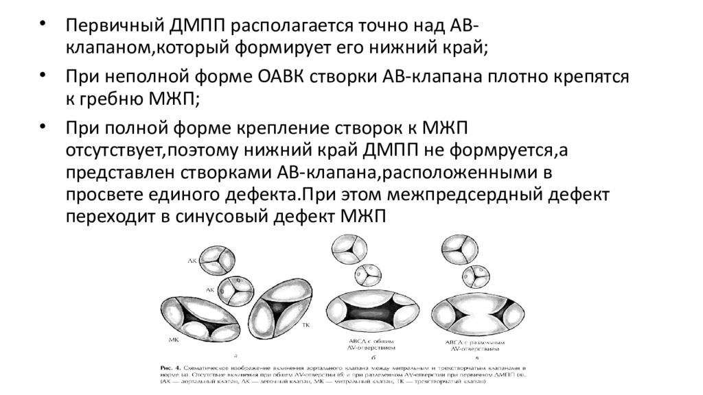 Открытый атриовентрикулярный канал презентация