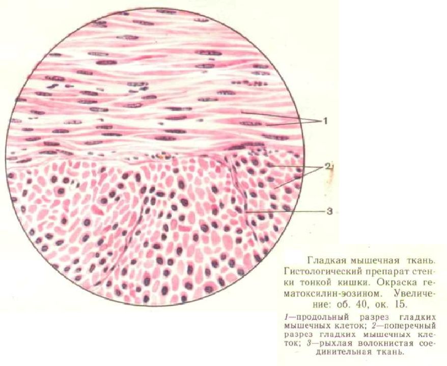 Гладкая мышечная рисунок. Гладкая мышечная ткань гистология. Препарат гладкая мышечная ткань окраска гематоксилин и эозин. Гладкая мышечная ткань мочевого пузыря. Гистологический препарат гладкой мышечной ткани.