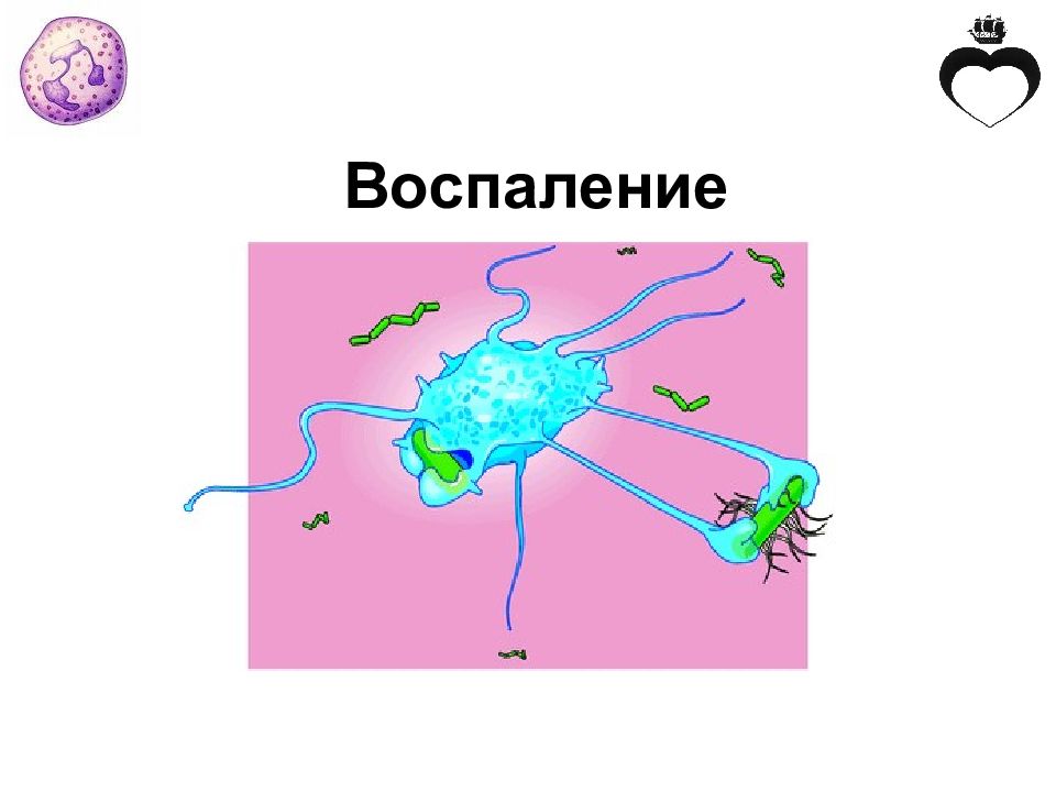Воспаление