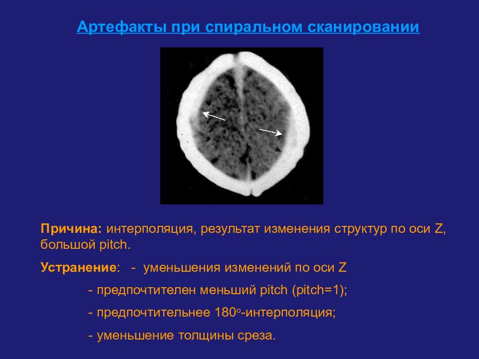 Уменьшение после кт