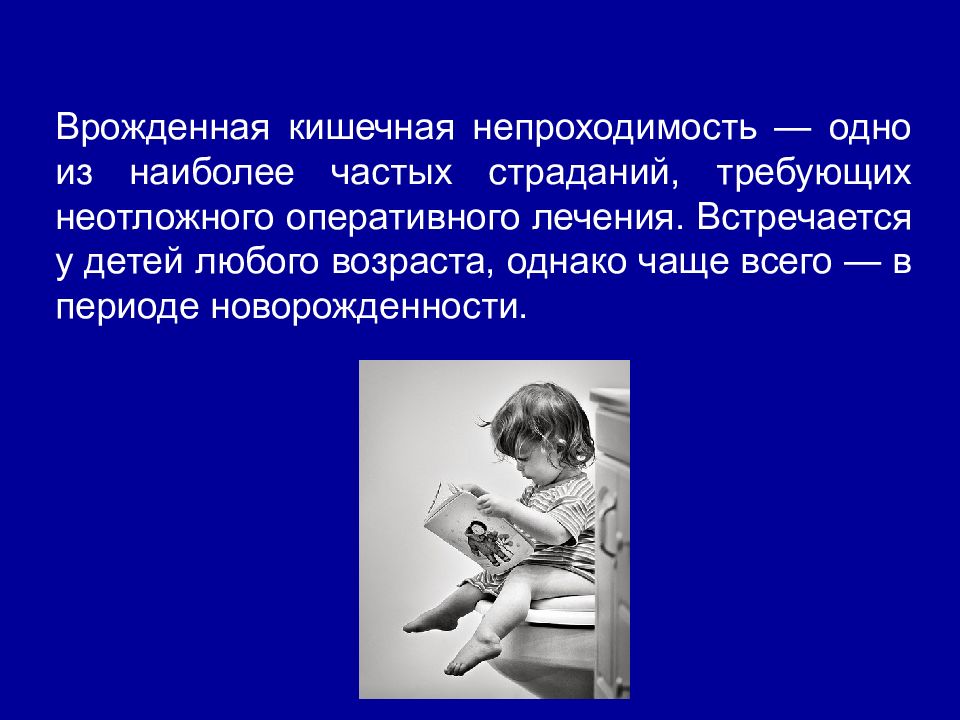 Врожденная кишечная. Врожденная кишечная непроходимость презентация. Врожденная кишечная непроходимость мкб 10.