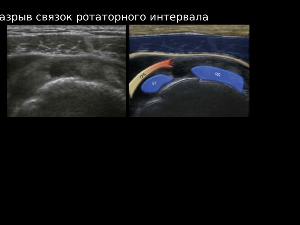 Узи плечевого сустава. Ультразвуковое исследование плечевого сустава брошюра.