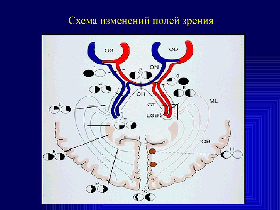 Схема полей зрения. Исследование полей зрения. Зрительный путь схема. Жи 93 исследований головного мозга топографических схем.