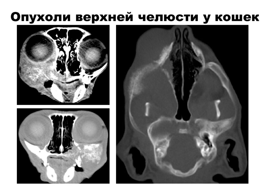 Кт лицевых костей. Компьютерная томография лицевого скелета. Компьютерная томография лицевого отдела черепа. Кт лицевого черепа \с контрастом. Кт анатомия лицевого отдела черепа.