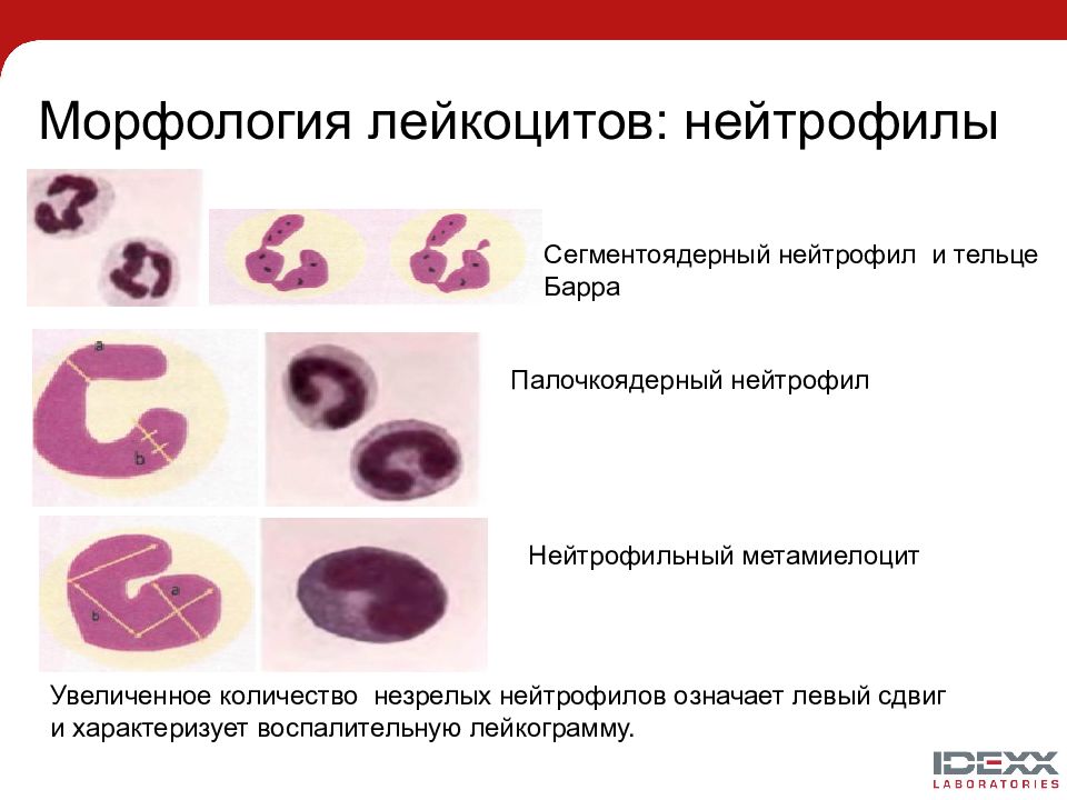 Палочкоядерные нейтрофилы картинки