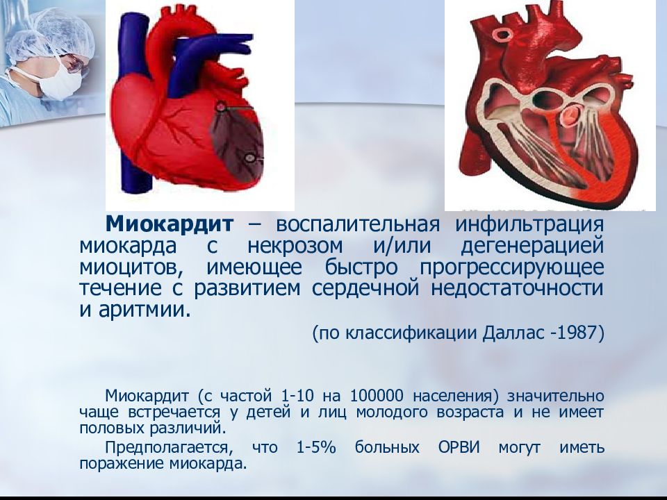 Миокардит картинки для презентации