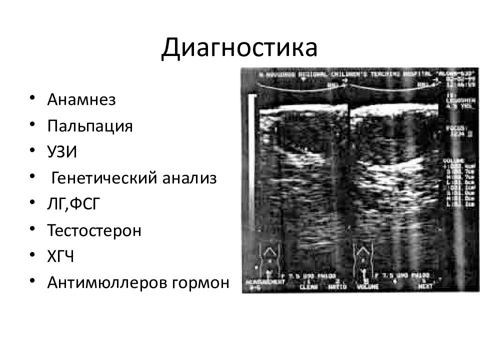 Крипторхизм презентация детская хирургия