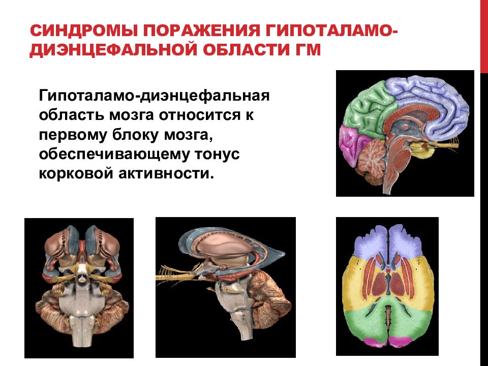 Диэнцефальная дисфункция головного мозга