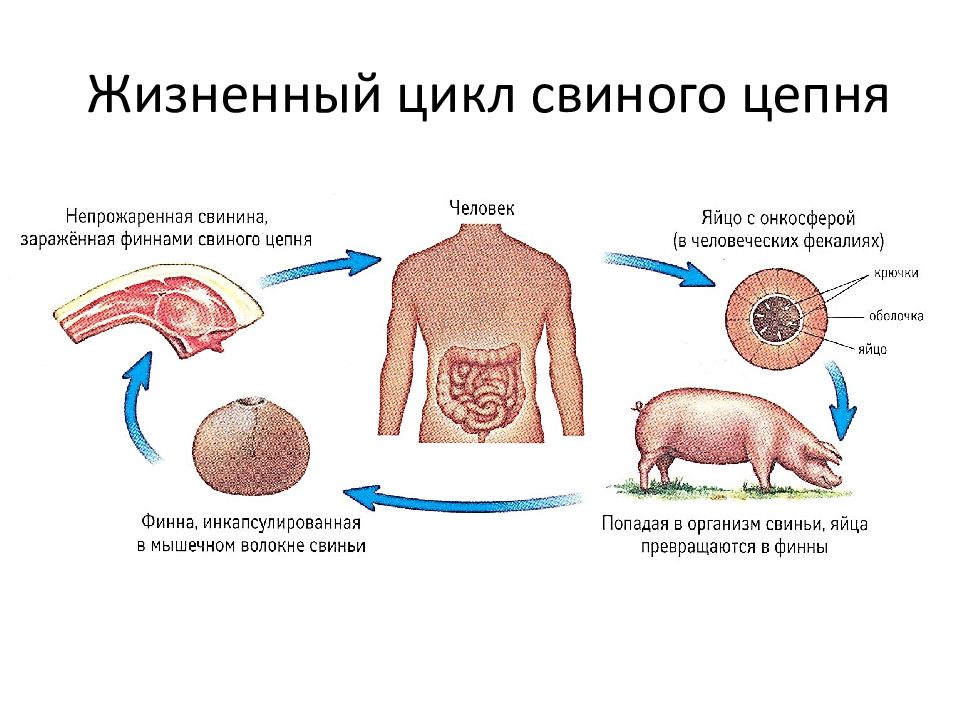 Инвазивная стадия свиного цепня