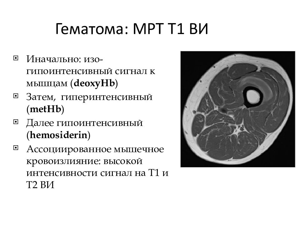 Т1 и т2 взвешенные изображения в мрт