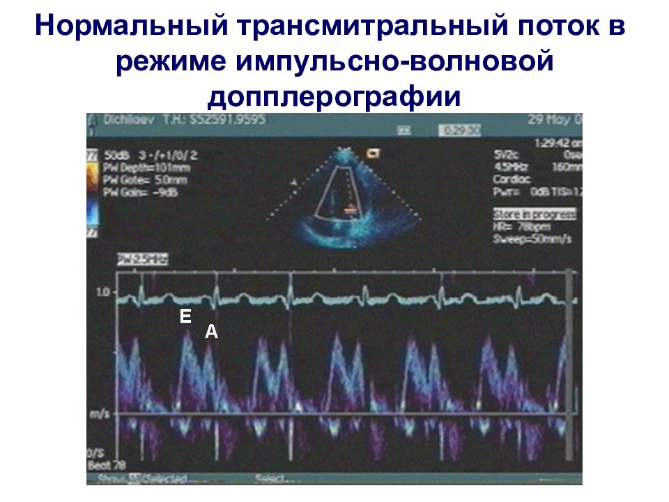 Учебный план эхокардиография