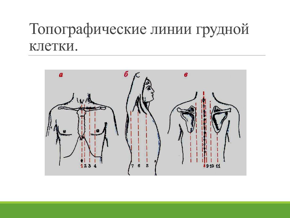 Условные линии. Топографические линии грудной клетки. Топографические линии грудной клетки пропедевтика. Клиническая топография грудной клетки. Клиническая топография грудной клетки пропедевтика.