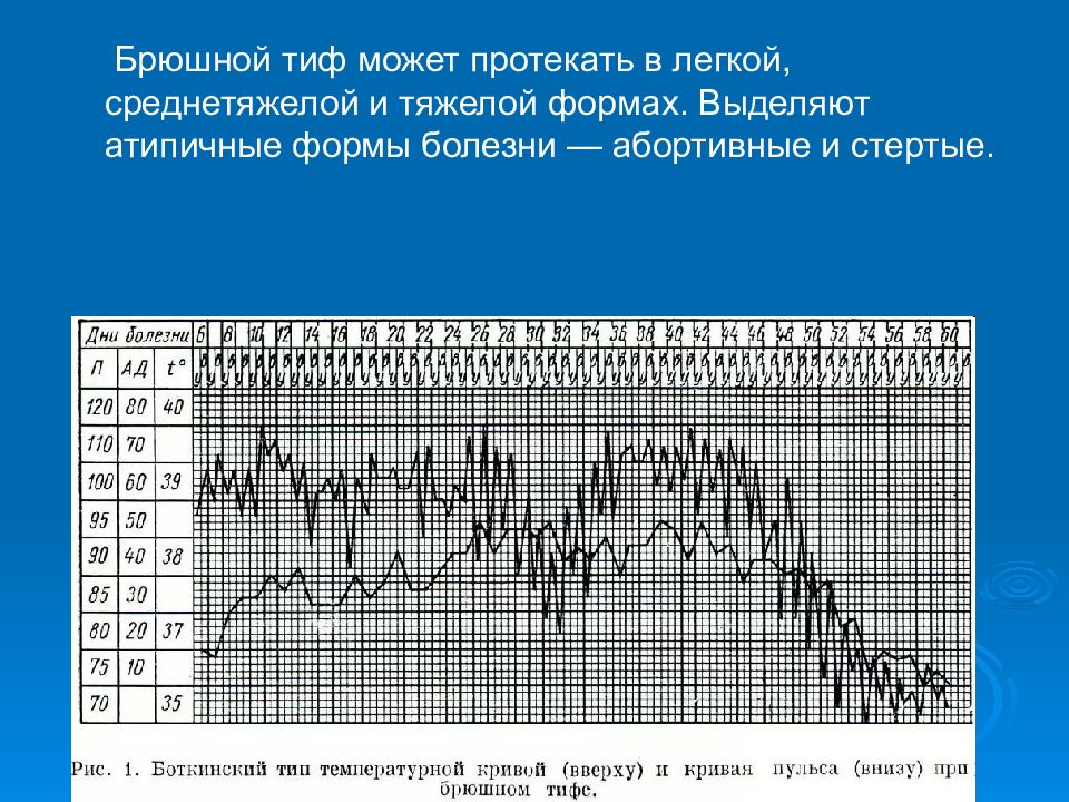 Уменьшить тиф изображение