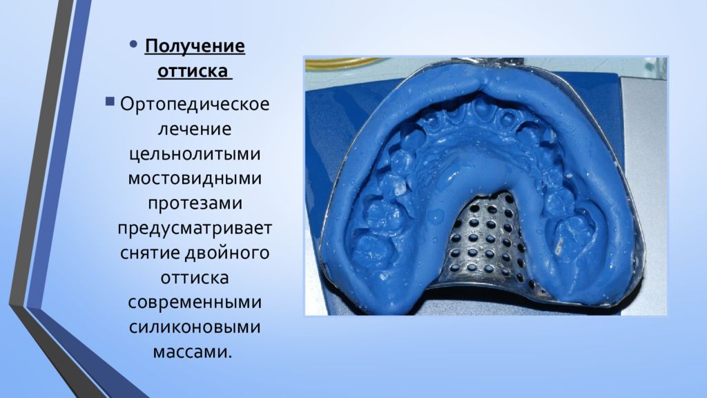 Оттиски в ортопедической стоматологии презентация