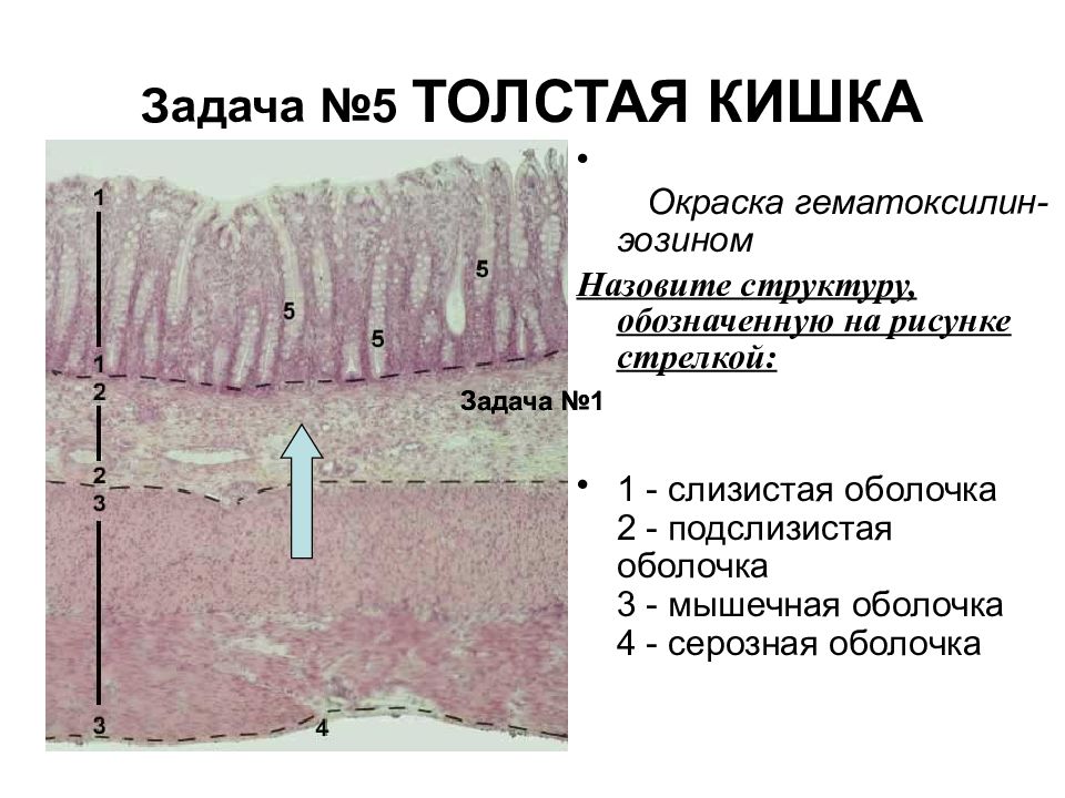 Толстая оболочка. Толстая кишка окраска гематоксилин-эозином. Толстая кишка гематоксилин эози. Гистология толстой кишки.