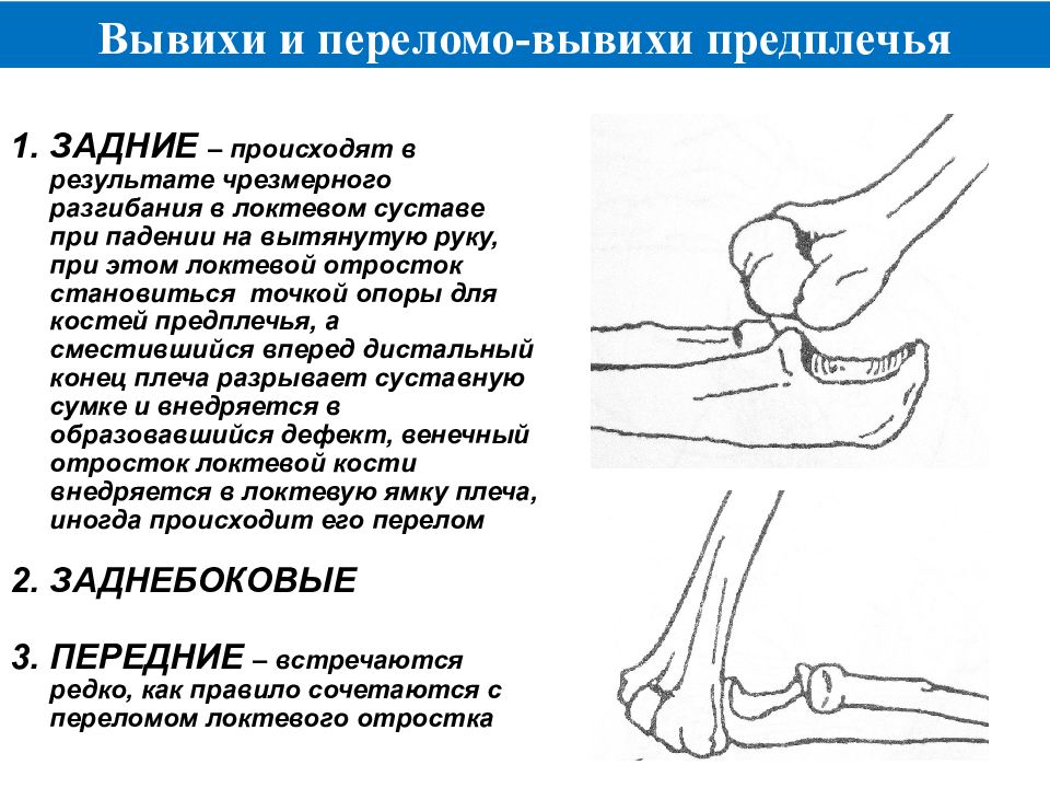 Закрытый перелом коленного сустава карта вызова