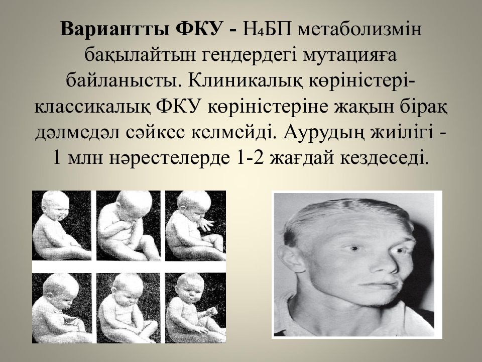 Жеке аминқышқылдардың алмасуы және оның бұзылуының биохимиялық негіздері Жеке аминқышқылдардың алмасуы және оның бұзылуының биохимиялық негіздері