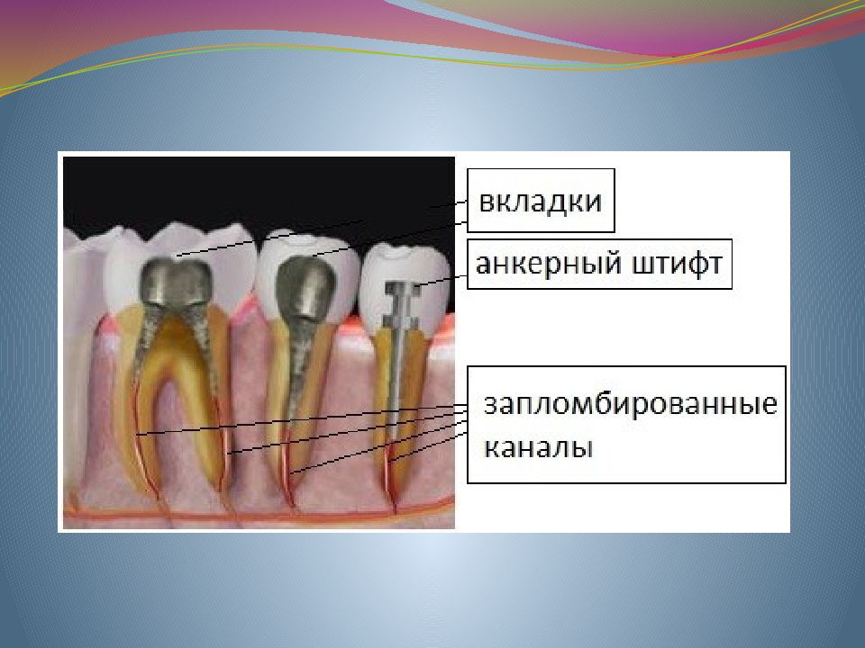 Ш тифтовые зубы» — презентация