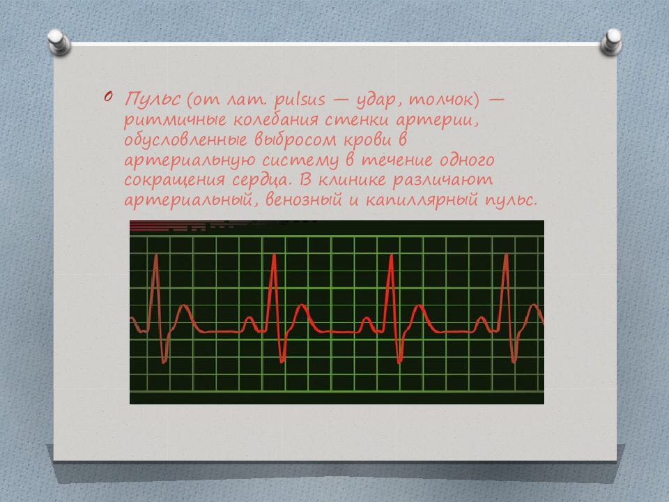 Низкий пульс. График пульса здорового человека. Колебания пульса. Хороший пульс. Сокращение артерий пульс.