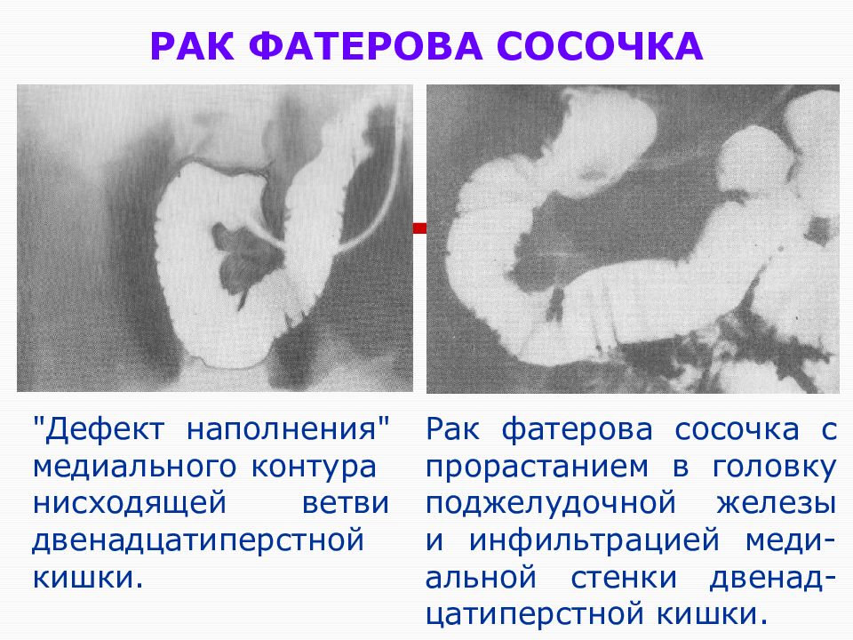 У аматорши большие соски