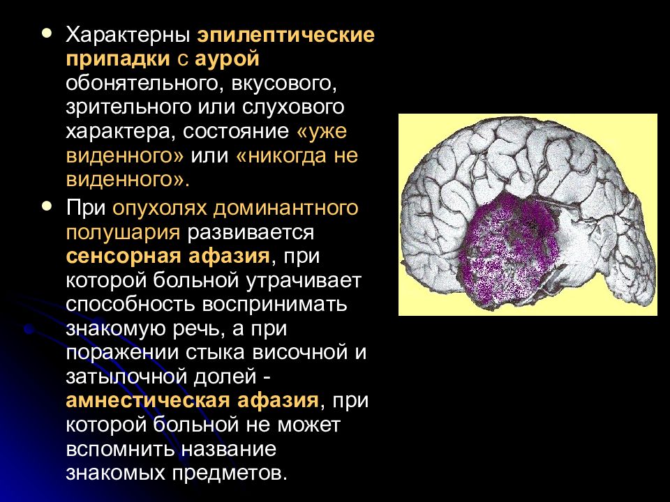 Опухоль мозга презентация