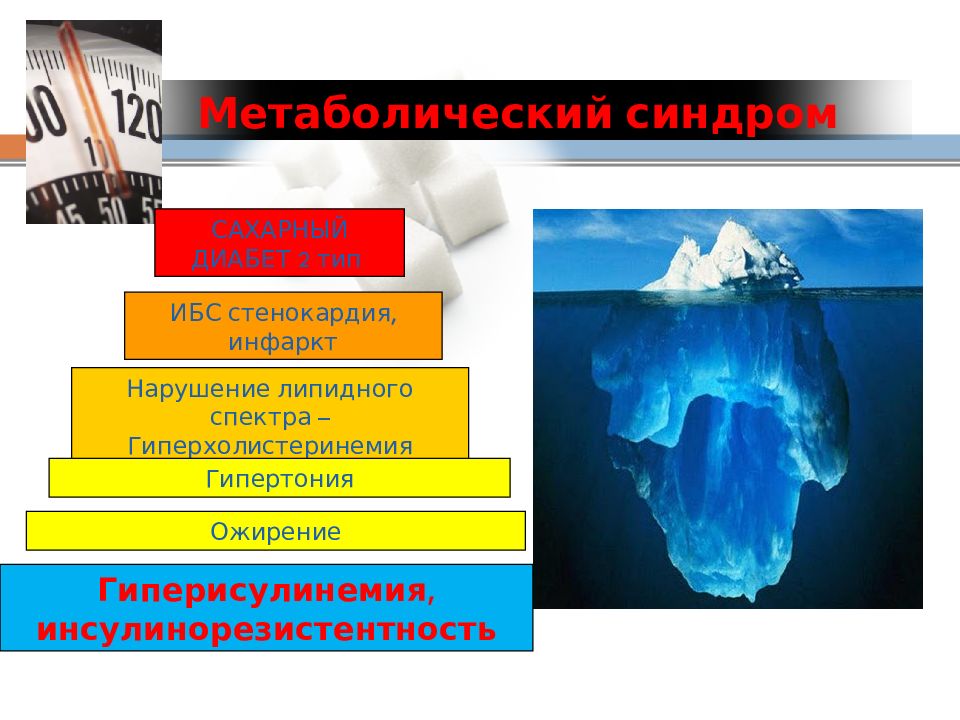 Сахарный синдром. Сахарный синдром