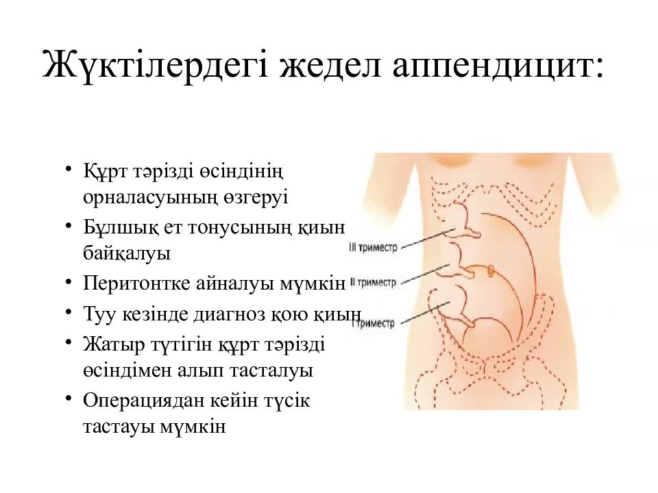 Жедел аппендицит. Аппендицит презентация. Аппендикс картинки для презентации.